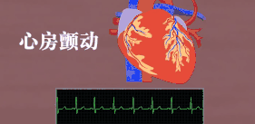 1【動圖_(2).png